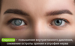 chto-takoe-glaukoma__fzh9QUnO81bRd27B.jpg